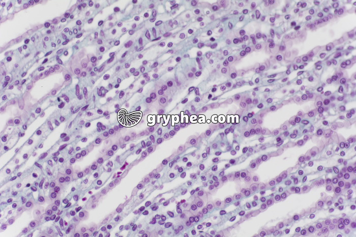 Rein tubules urinaires CL x100 - gryphea.com